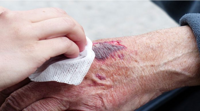 Poderosos desinfectantes naturales